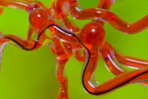 简讯美研发磁控线型机器人有望用于脑血管手术 简讯美研发磁控线型机器人有望用于脑血管手术