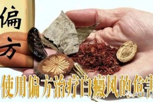 还再四处寻找银屑病偏方你一定不知道这些偏方的危害 还再四处寻找银屑病偏方你一定不知道这些偏方的危害
