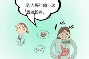 无痛内镜让胃肠镜检查不再可怕 无痛内镜让胃肠镜检查不再可怕