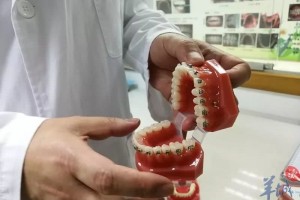 预防牙畸形从小就得注意 预防牙畸形从小就得注意
