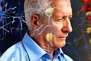 如果真的不幸患上了老年痴呆症一般会有哪些表现呢 如果真的不幸患上了老年痴呆症一般会有哪些表现呢