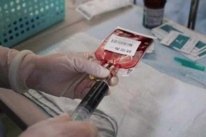 感染乙肝后应该如何养生远离这几种食物对肝脏健康十分有益 感染乙肝后应该如何养生远离这几种食物对肝脏健康十分有益