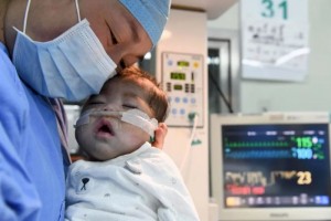 66天女婴换上4岁男童心脏创造纪录令人泪目