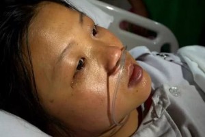 尿毒症女子越透析越严重都是丈夫不知克制惹的祸