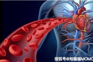 熬夜说出来你可能不信甲状腺癌就是这么来的 熬夜说出来你可能不信甲状腺癌就是这么来的
