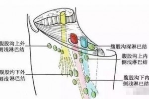 腹股沟淋巴是各种妇科病的源头万万不可堵 腹股沟淋巴是各种妇科病的源头万万不可堵