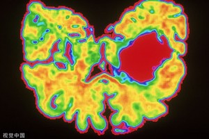 命短的人大多是跨不过这3道坎你要加油了 命短的人大多是跨不过这3道坎你要加油了