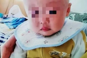 半岁男孩脑袋越长越斜医师查看后发现工作严峻 半岁男孩脑袋越长越斜医师查看后发现工作严峻