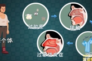 跑步能够医治鼻炎吗