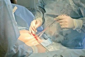 别被骗了这才是女性刚生完娃实在的样产后20天的肚子让人心酸 别被骗了这才是女性刚生完娃实在的样产后20天的肚子让人心酸