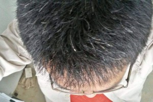 青丝不能拔会越拔越多青丝不能染染发致癌真是这样吗 青丝不能拔会越拔越多青丝不能染染发致癌真是这样吗