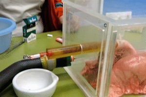 戒烟丨3包烟就能熏黑气管 戒烟丨3包烟就能熏黑气管