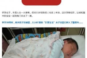 女性的子宫能剖几回医师这样说 女性的子宫能剖几回医师这样说