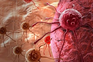 癌症并非出人意料身上这5个不起眼的小症状早已告诉你