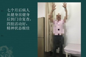 一例巨大脑室内肿瘤的手术医治——手术后七个月患者从健身房快乐地来到门诊 一例巨大脑室内肿瘤的手术医治——手术后七个月患者从健身房快乐地来到门诊