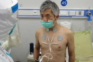 使用体外膈肌起搏器上海援鄂医师协助患者进行肺功用康复训练 使用体外膈肌起搏器上海援鄂医师协助患者进行肺功用康复训练