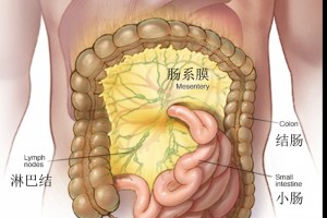 得了肠系膜淋巴结炎怎么办 得了肠系膜淋巴结炎怎么办