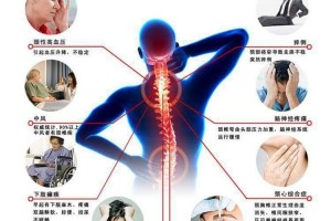 骨病常见病变分型及临床症状体现老张家膏贴使用范围 骨病常见病变分型及临床症状体现老张家膏贴使用范围