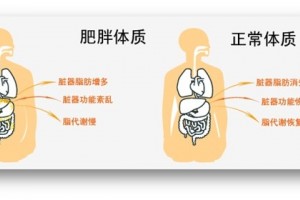 易胖体质的女人怎样瘦身才正确 易胖体质的女人怎样瘦身才正确