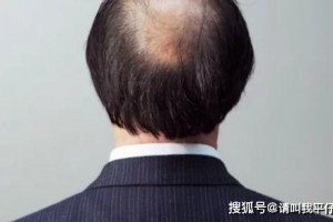 男性身体呈现3个特征阐明身体开端变老很多人不了解 男性身体呈现3个特征阐明身体开端变老很多人不了解